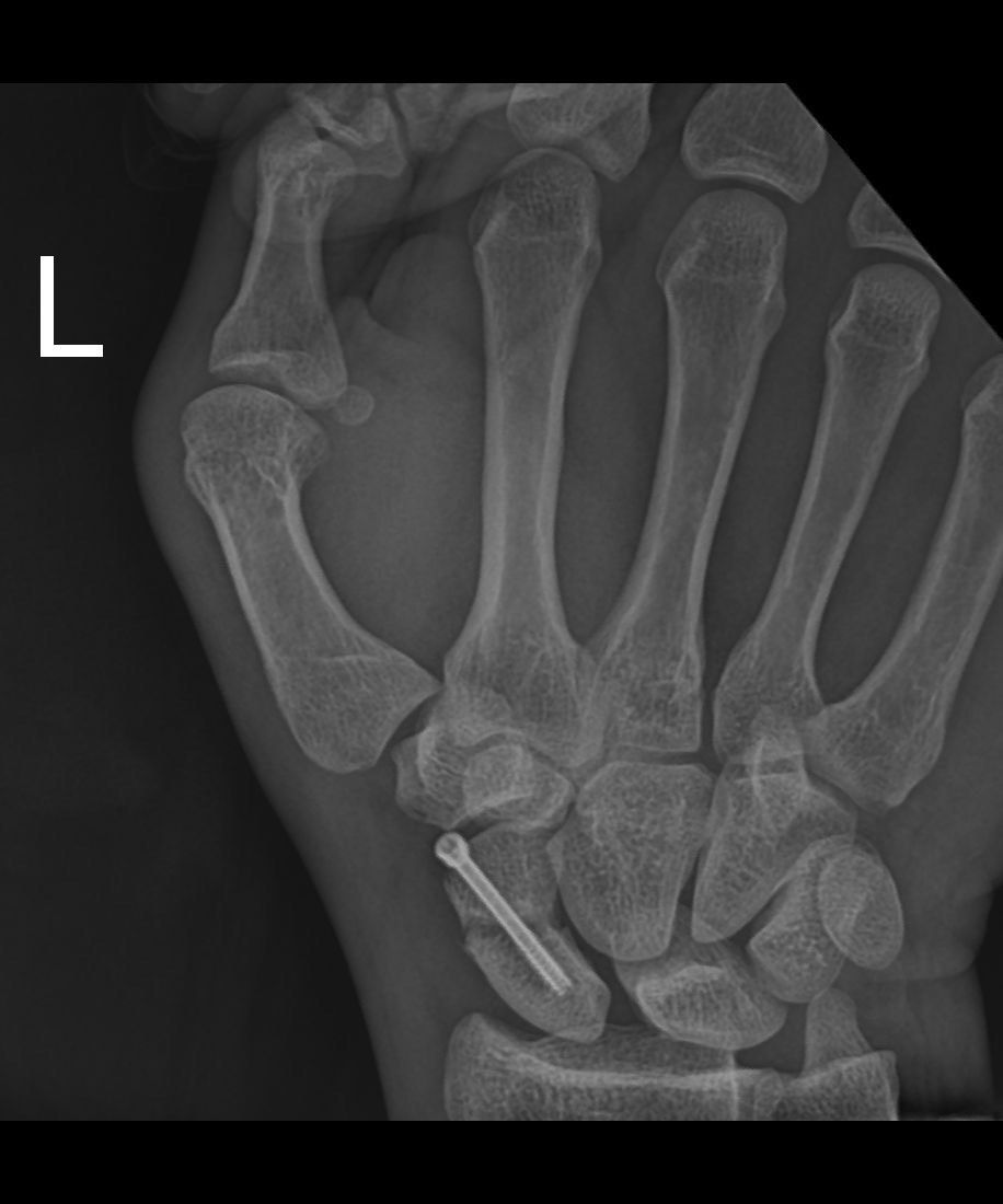 Carlos Humberto Vera Torres-2