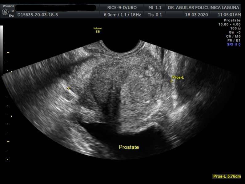 Edgar Fernando Aguilar Morales-3