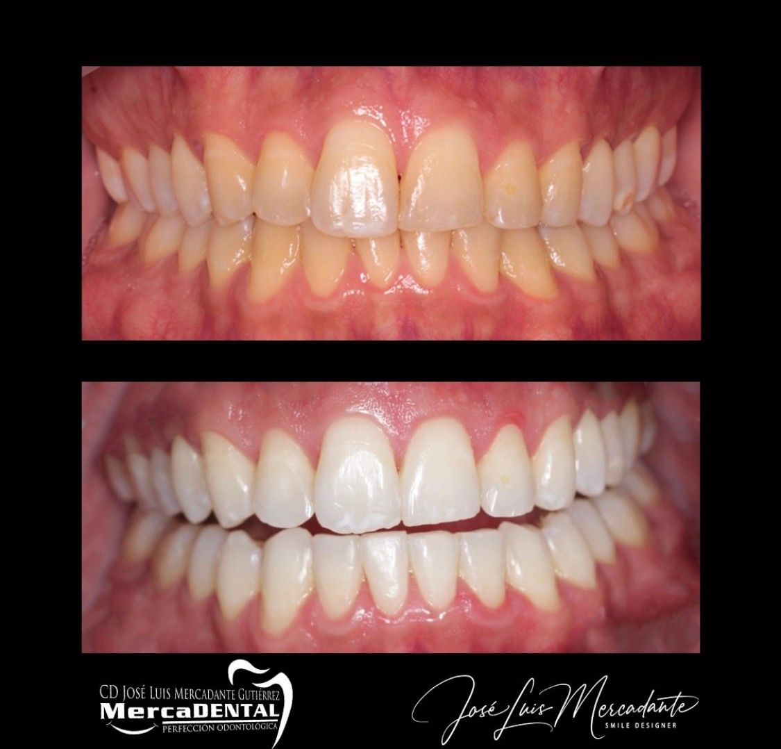 José Luis Mercadante Gutiérrez-49