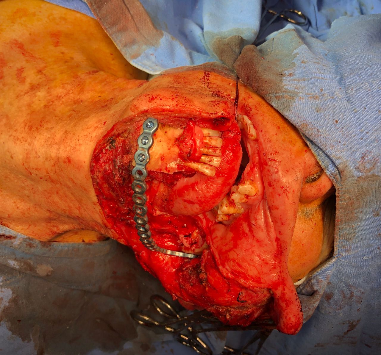 Luis Humberto Garcia Cabrera-6