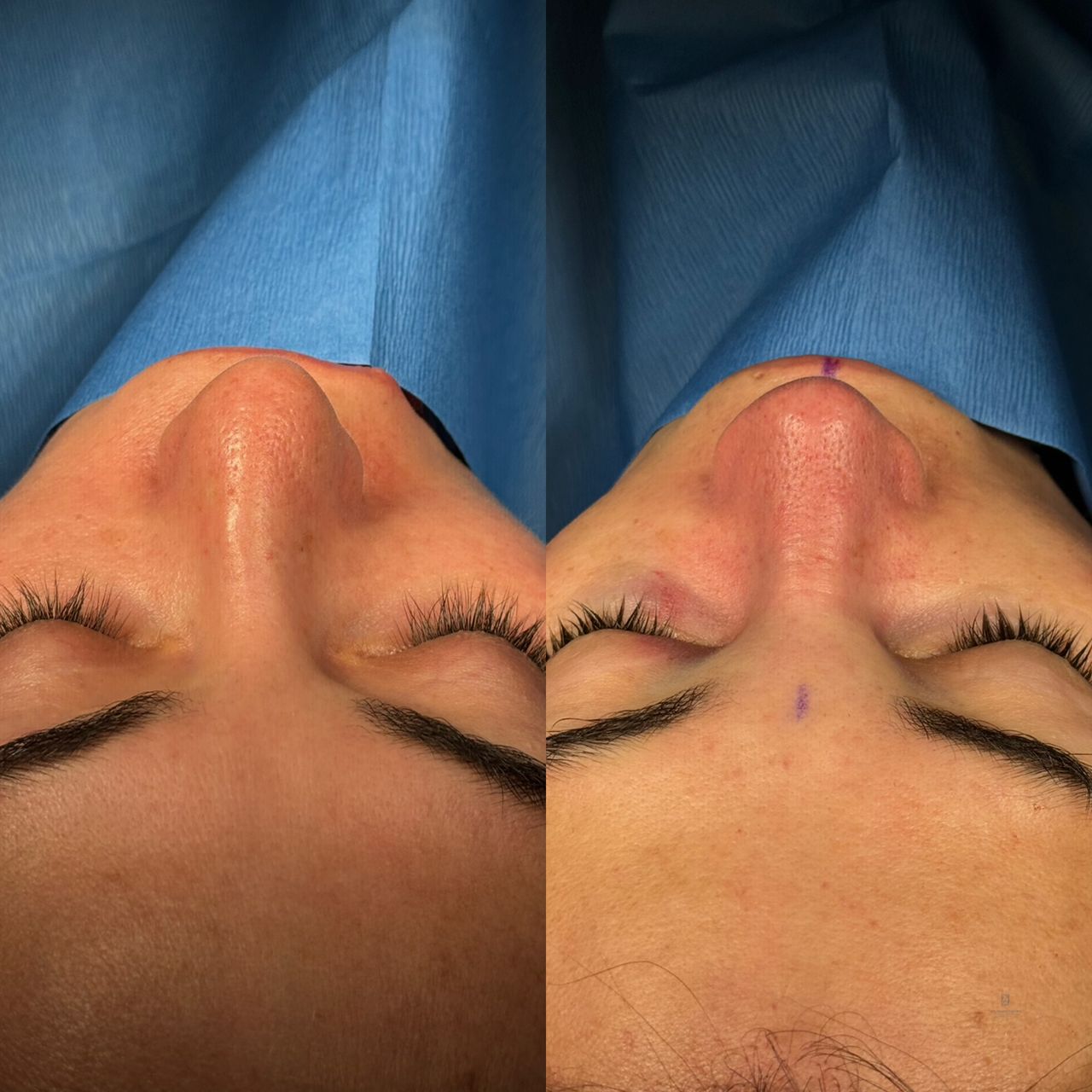 Angel Castro Urquizo-21