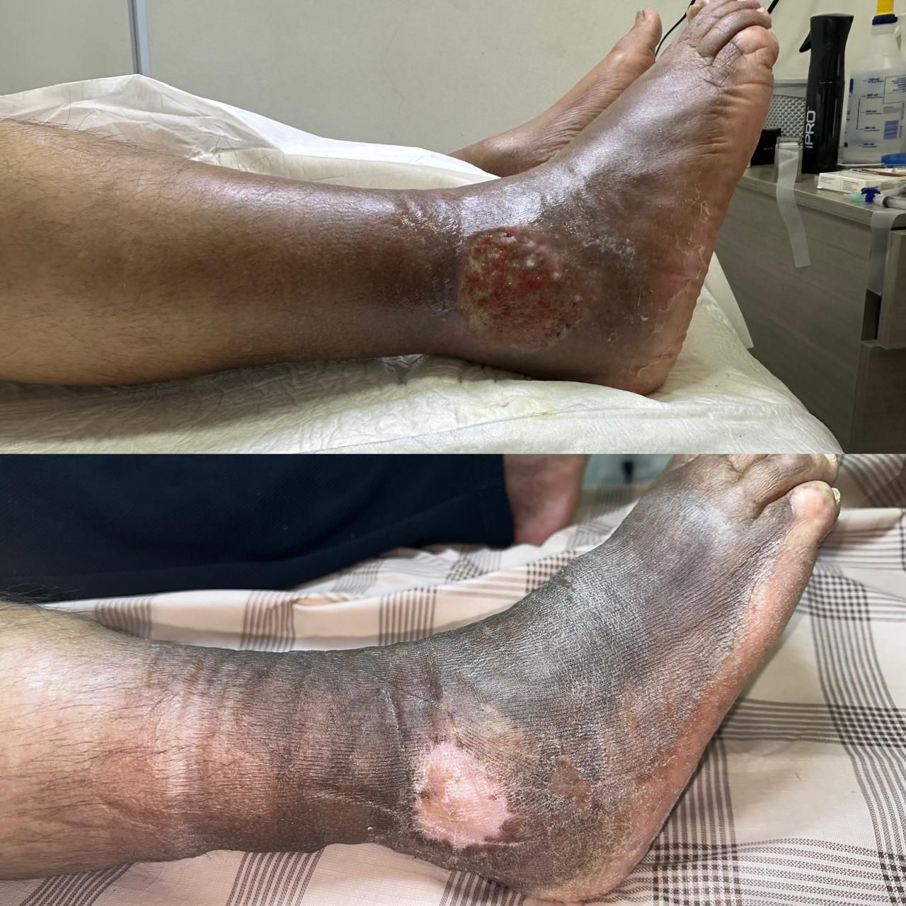 Jhonatan López González-32