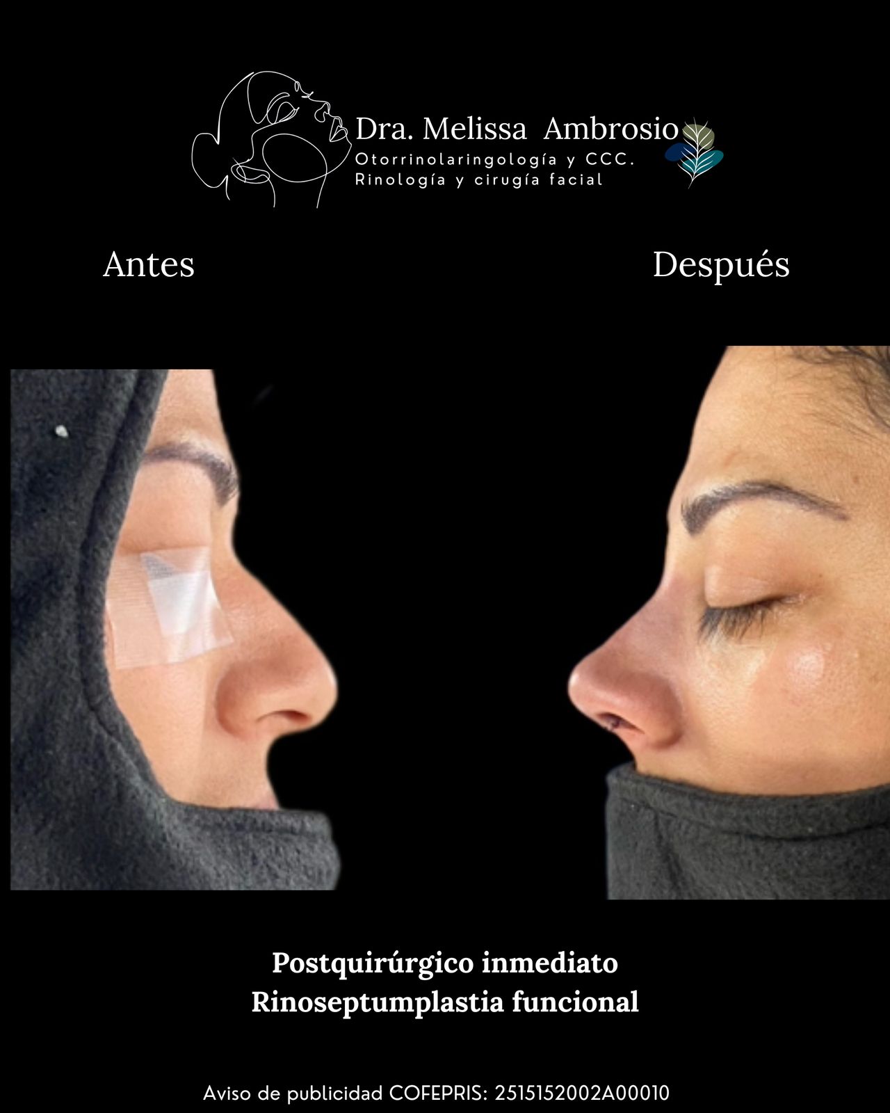 Melissa Guadalupe Ambrosio Mendoza-1