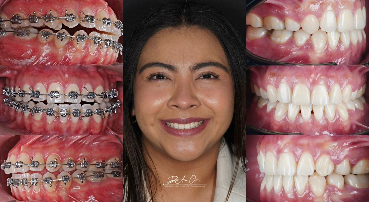 Alan Ortiz-5
