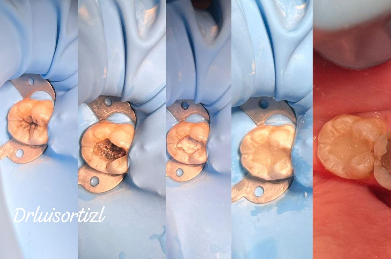 Luis Ángel Ortiz López-27