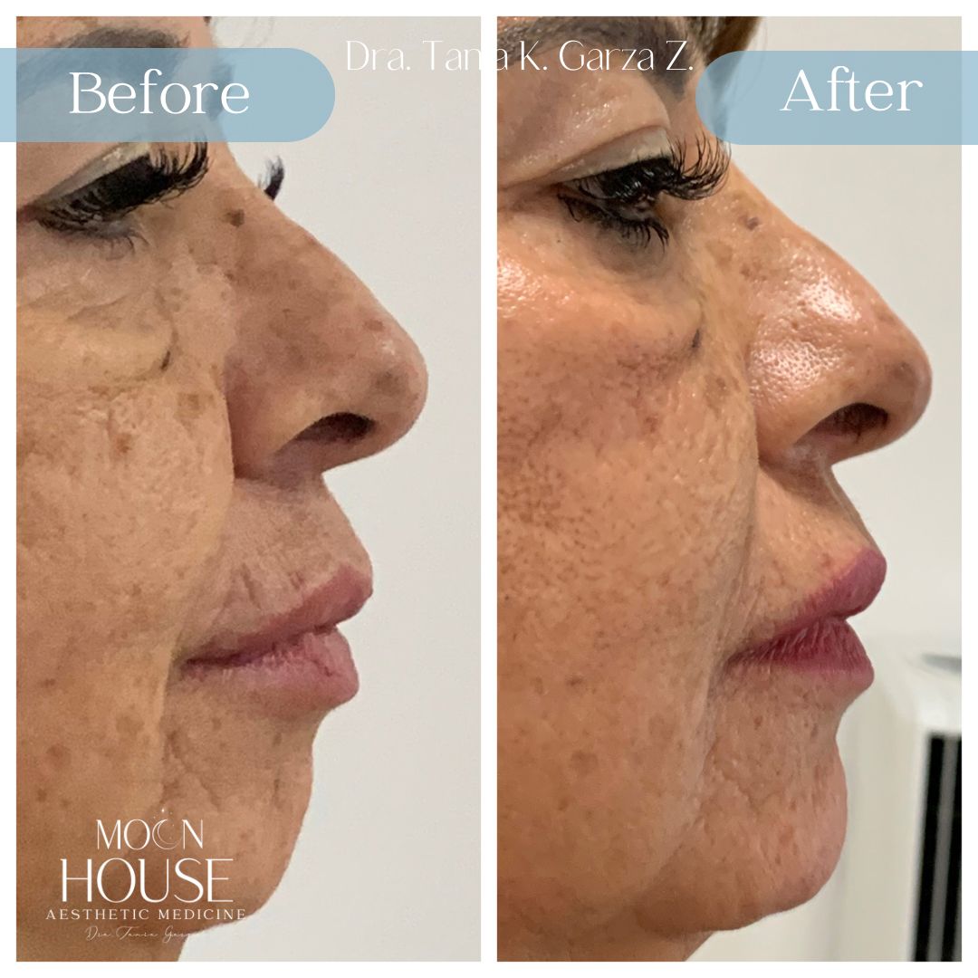 Tania Karine Garza Zepeda-25