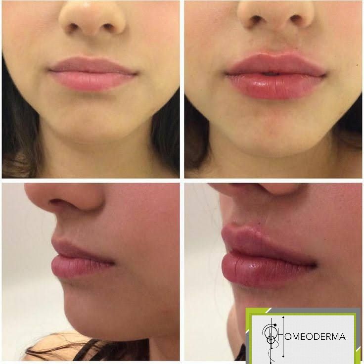 Gilliar Emmanuel Eudave De Lima-1