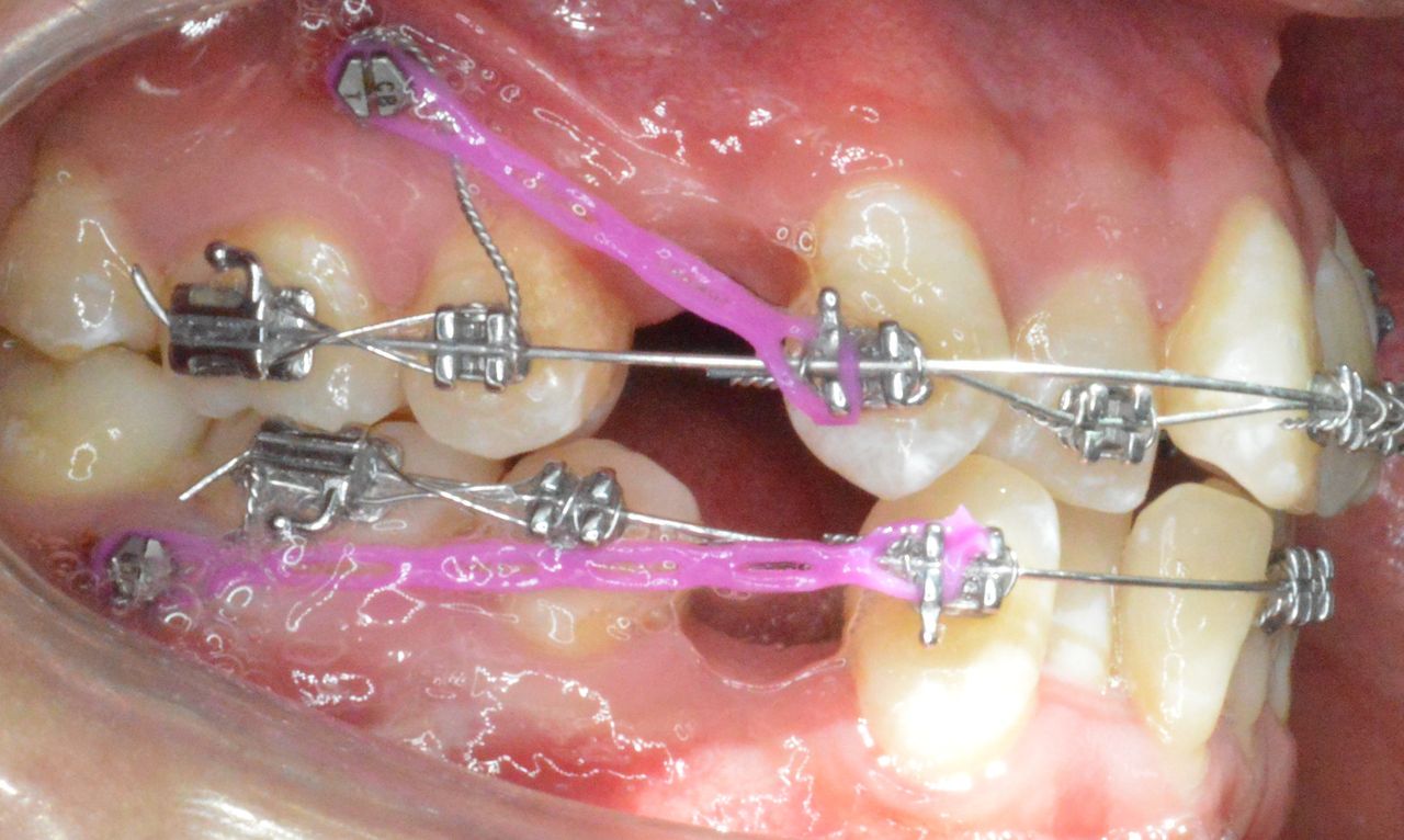 Valeria Xancopinca-8