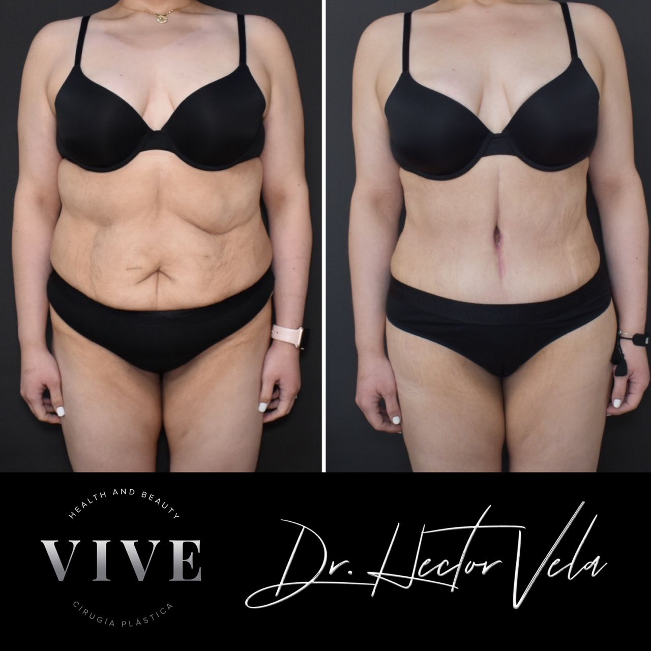 Héctor Eduardo Vela Cardona-311