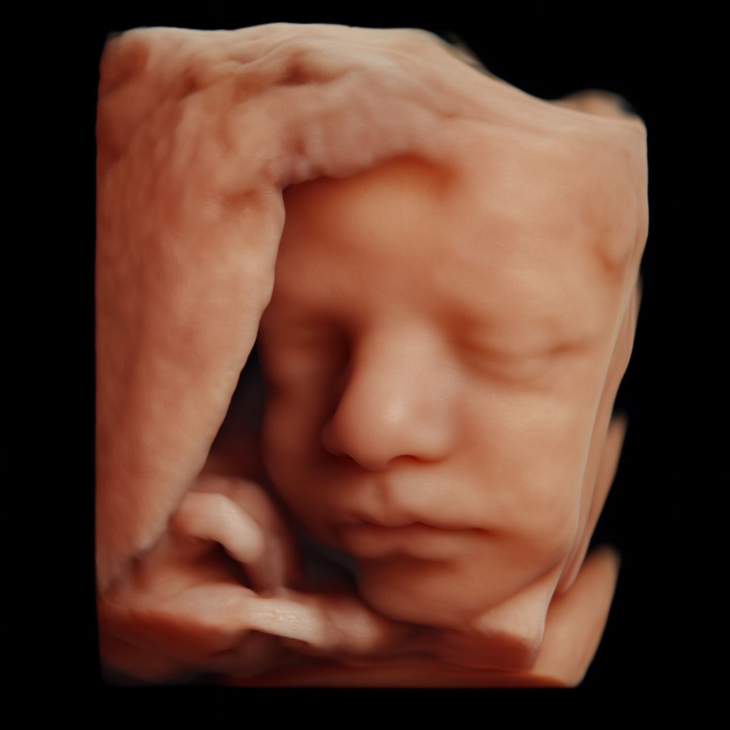 Fernando Roldan Arce-5