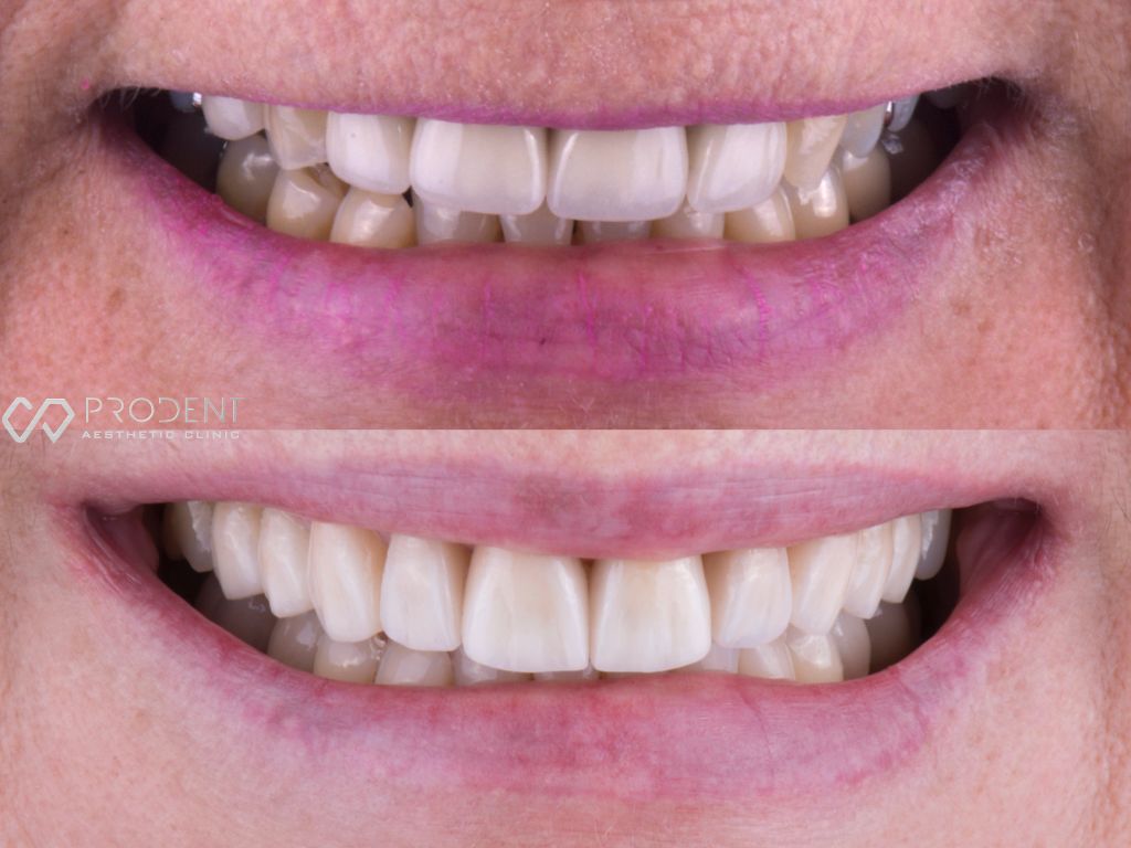 Ramiro Ivan Pérez Murillo-37