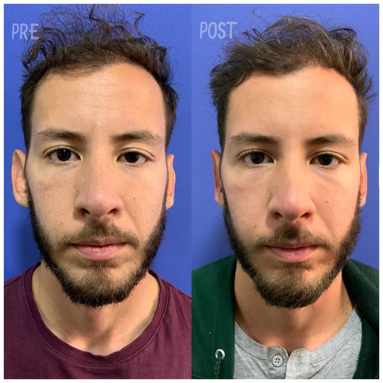 Giuseppe Tanzillo-81