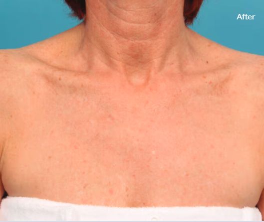 Jorge Luis Villalobos Ibarra-11