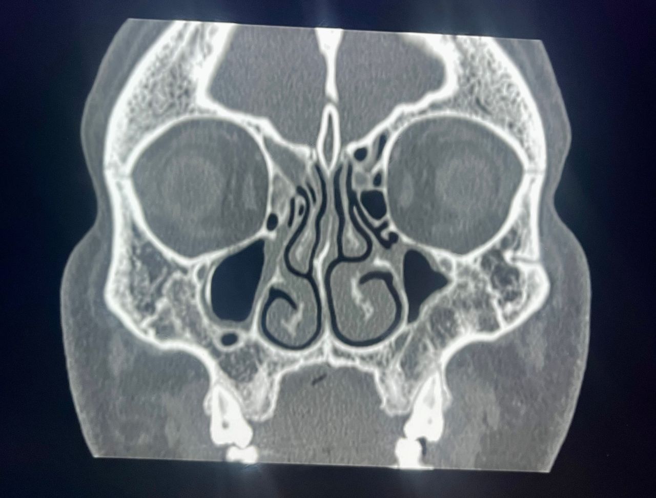 Rogelio Hernández García-60