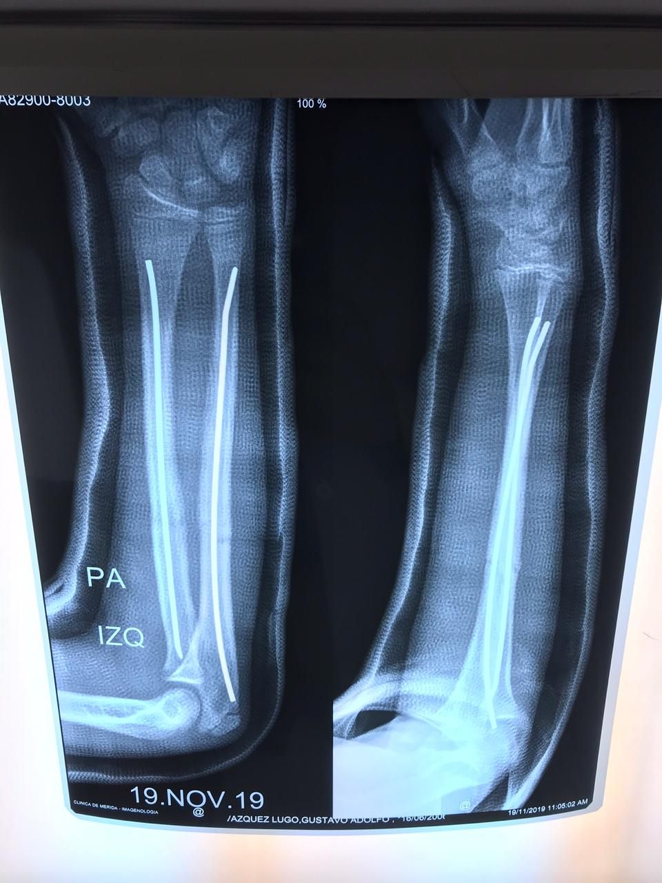 Victor Manuel Alayon Vazquez-5