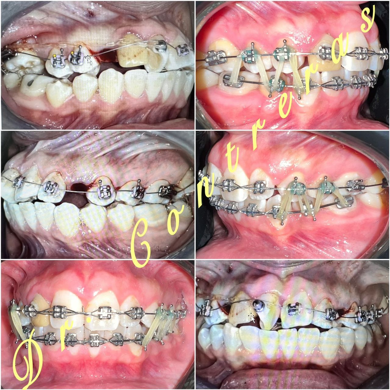 Jair Contreras García-36