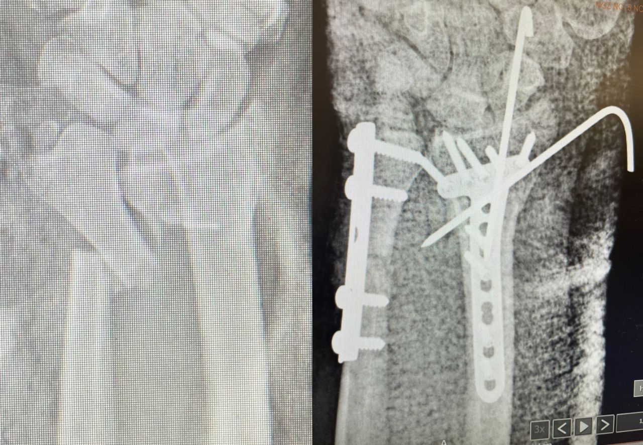 Diego Armando Contreras Rojas-4