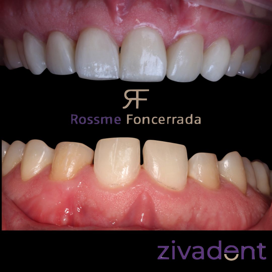 Rossme Foncerrada-14