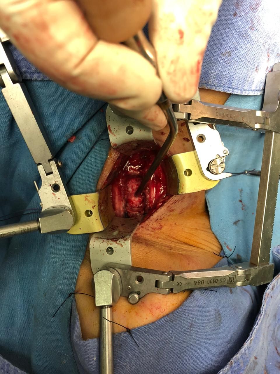 Juan José Luévano De La Cruz-10