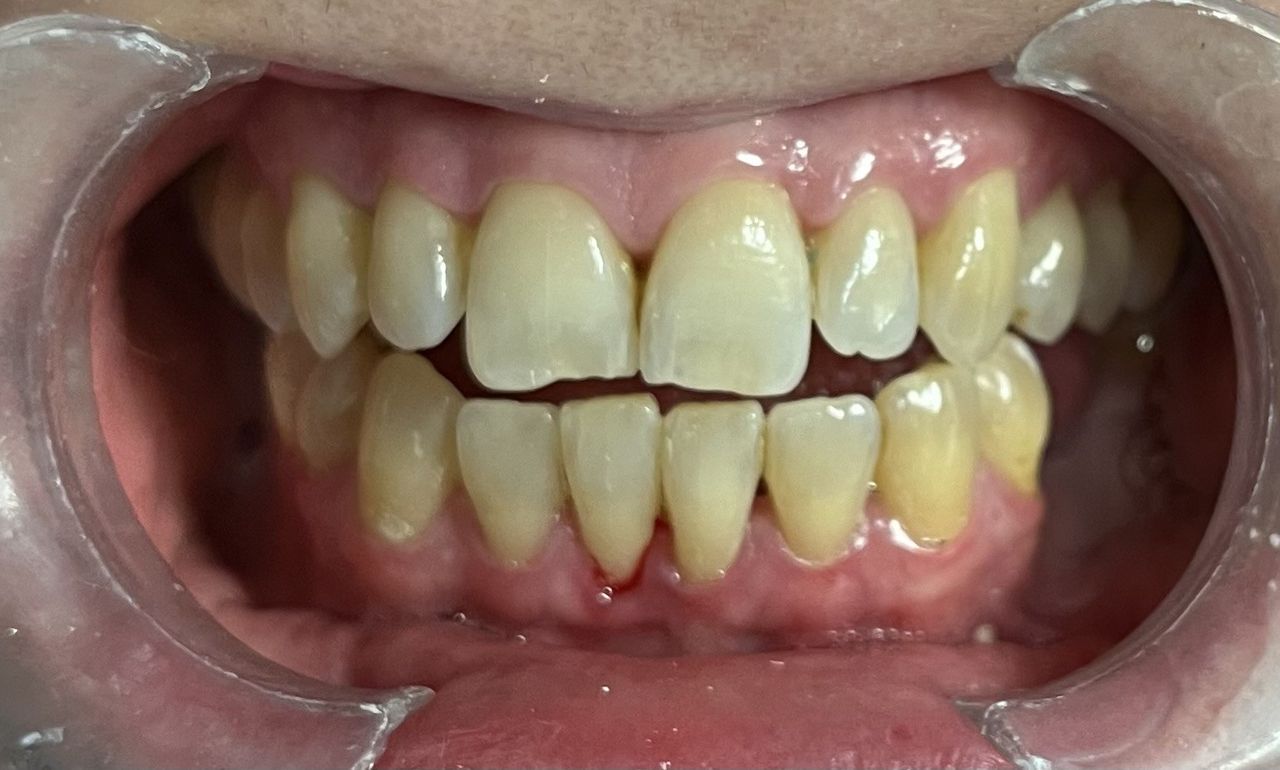 Esmeralda Candida Guerrero Pimentel-20