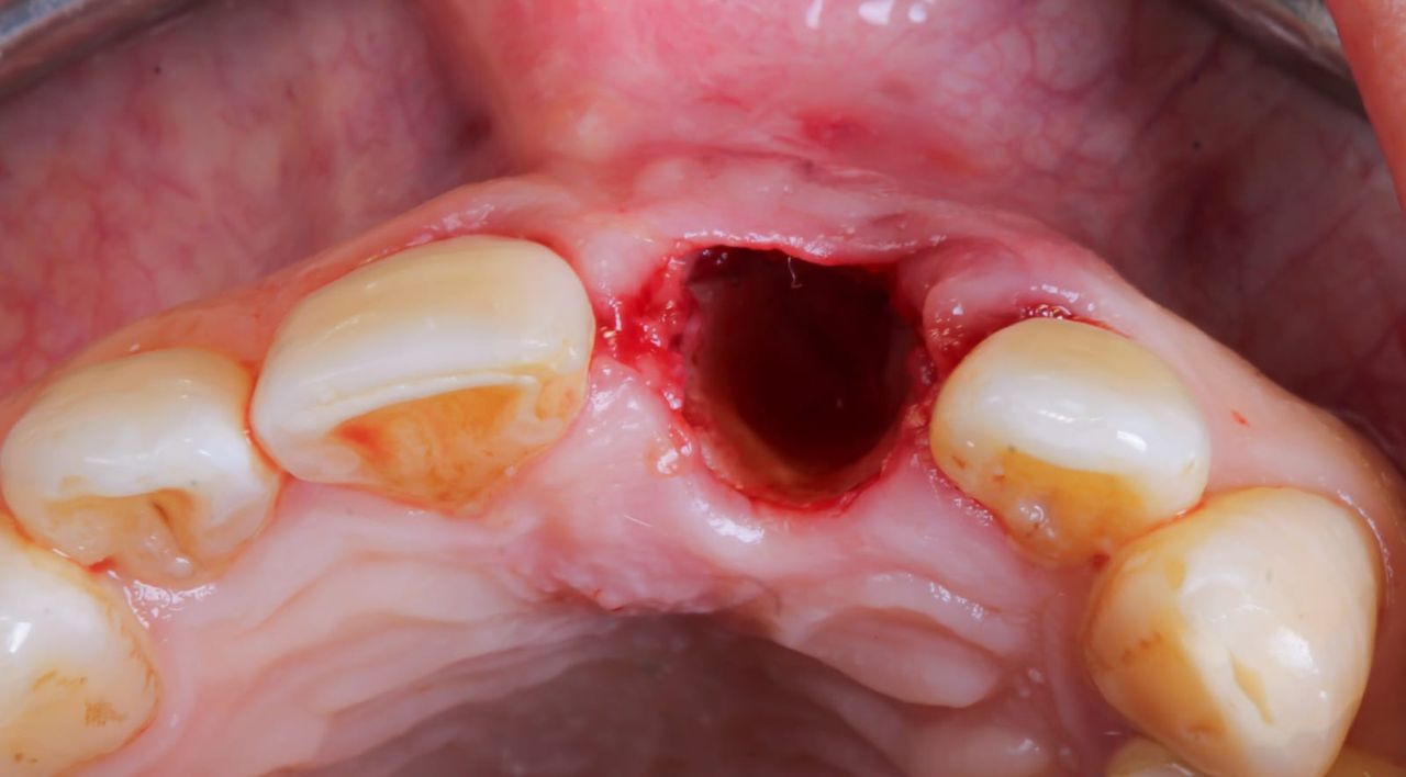 Hugo Enrique Aguilar Lamas-15