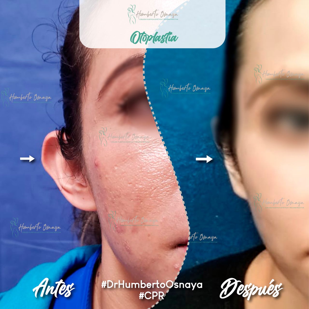 Humberto Osnaya Moreno-38