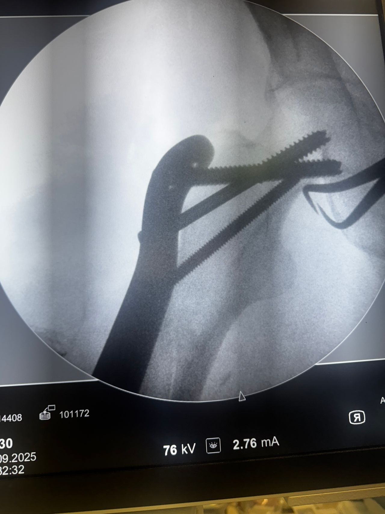 Benjamín Contreras Muñoz-9