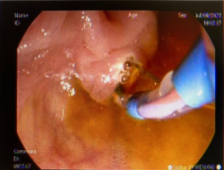 J. César Reyes Vásquez-17