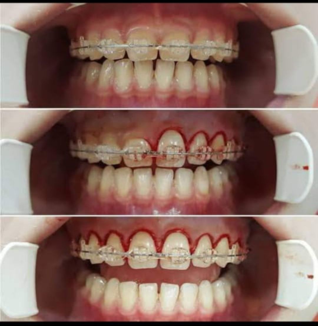 Oscar Cortez Perez-3