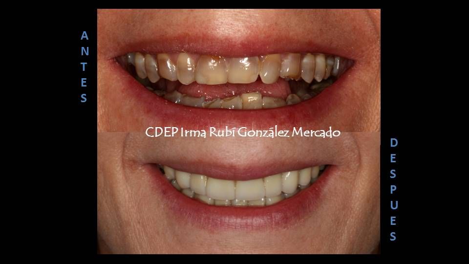 Irma Rubí González Mercado-4