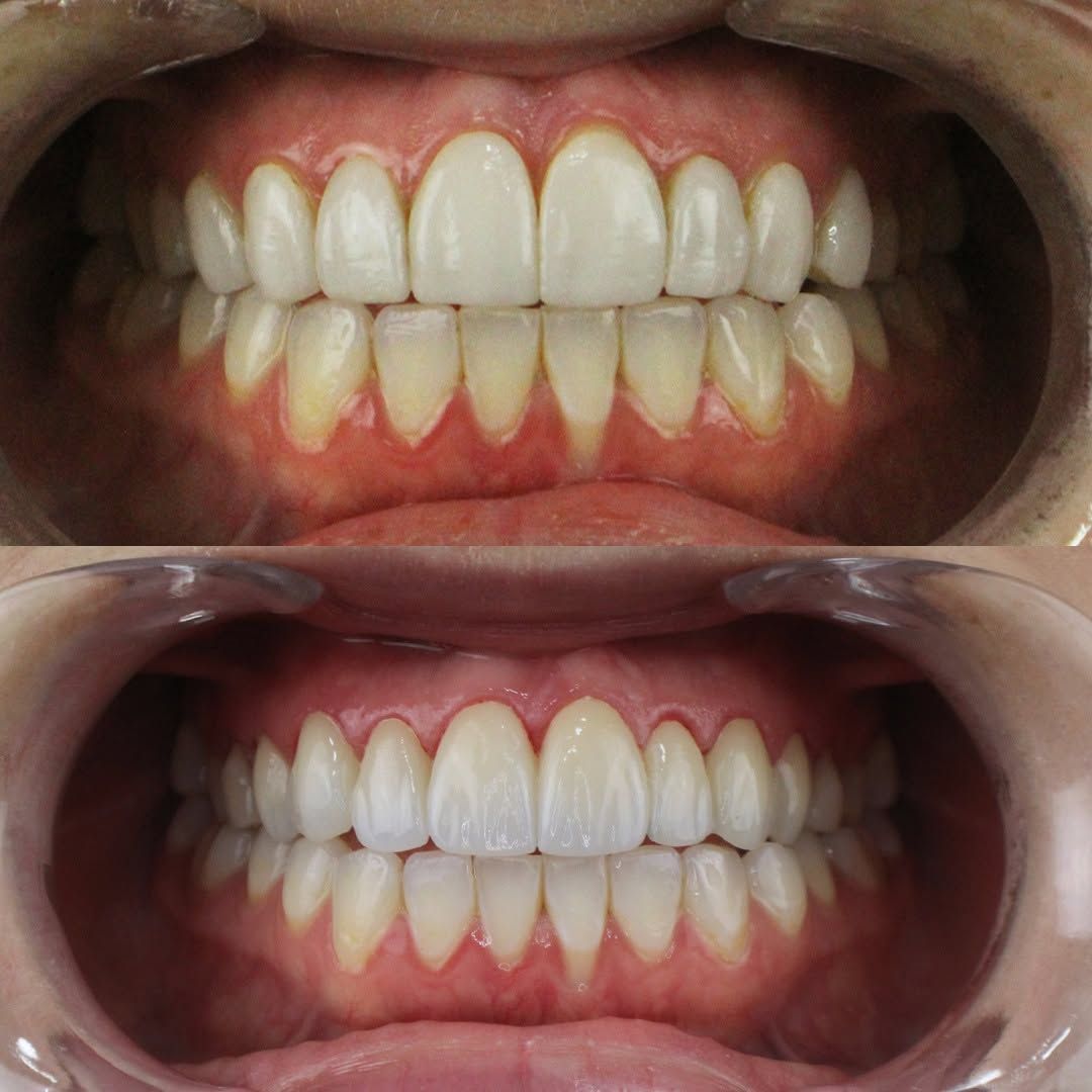 Alejandro Bates Souza-6