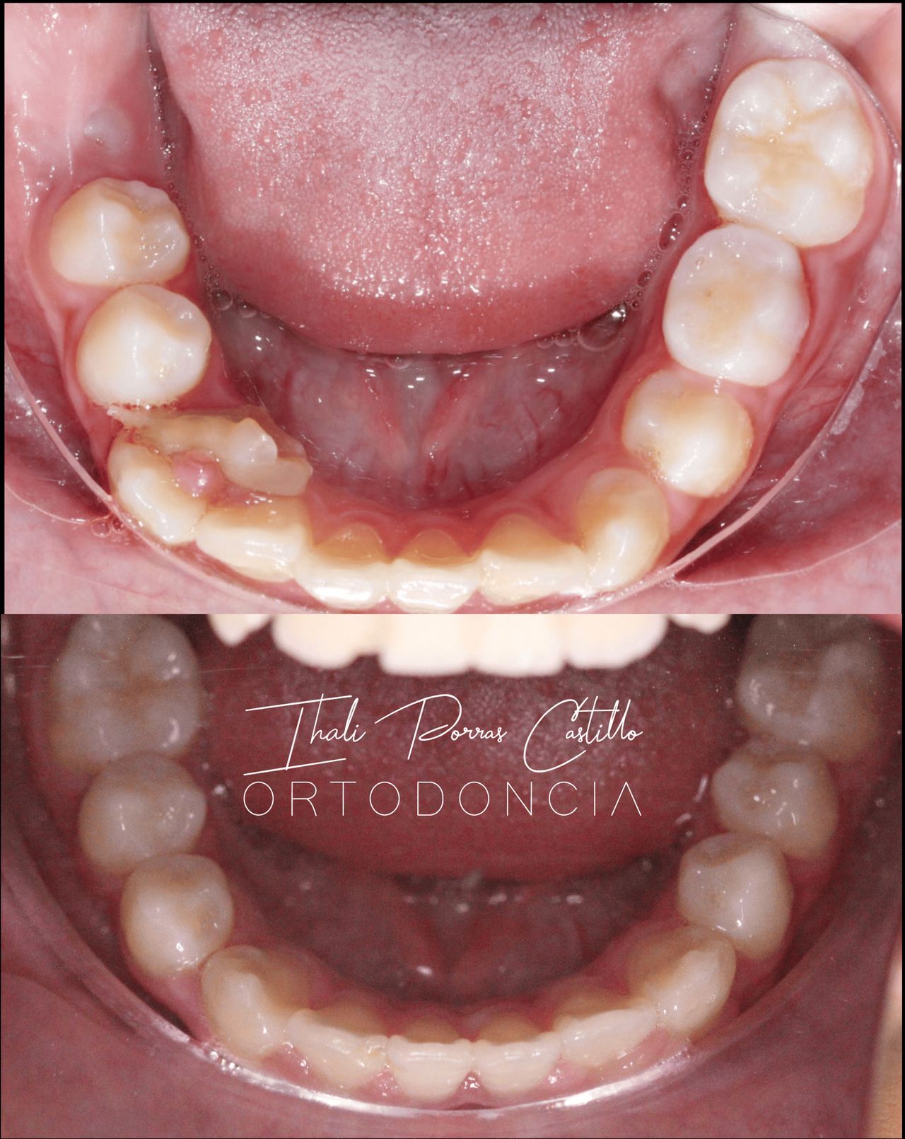 Ihali Porras Castillo-1