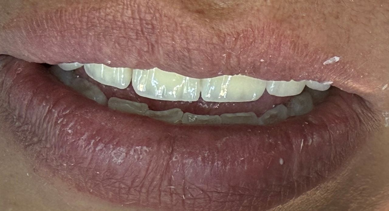 Jair Contreras García-51