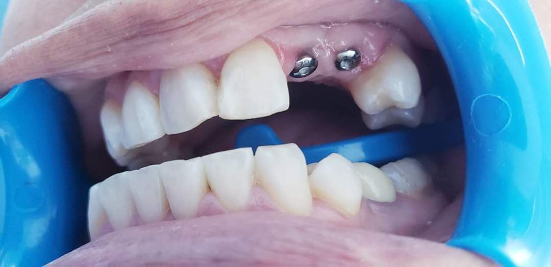 Mara Patricia Cercas López-8