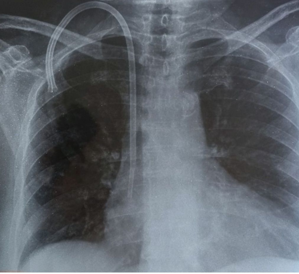 Leonardo Orozco Pérez-3