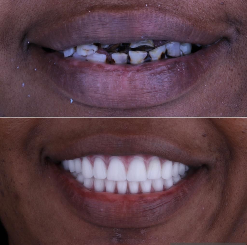 Josué Márquez Gómez-62