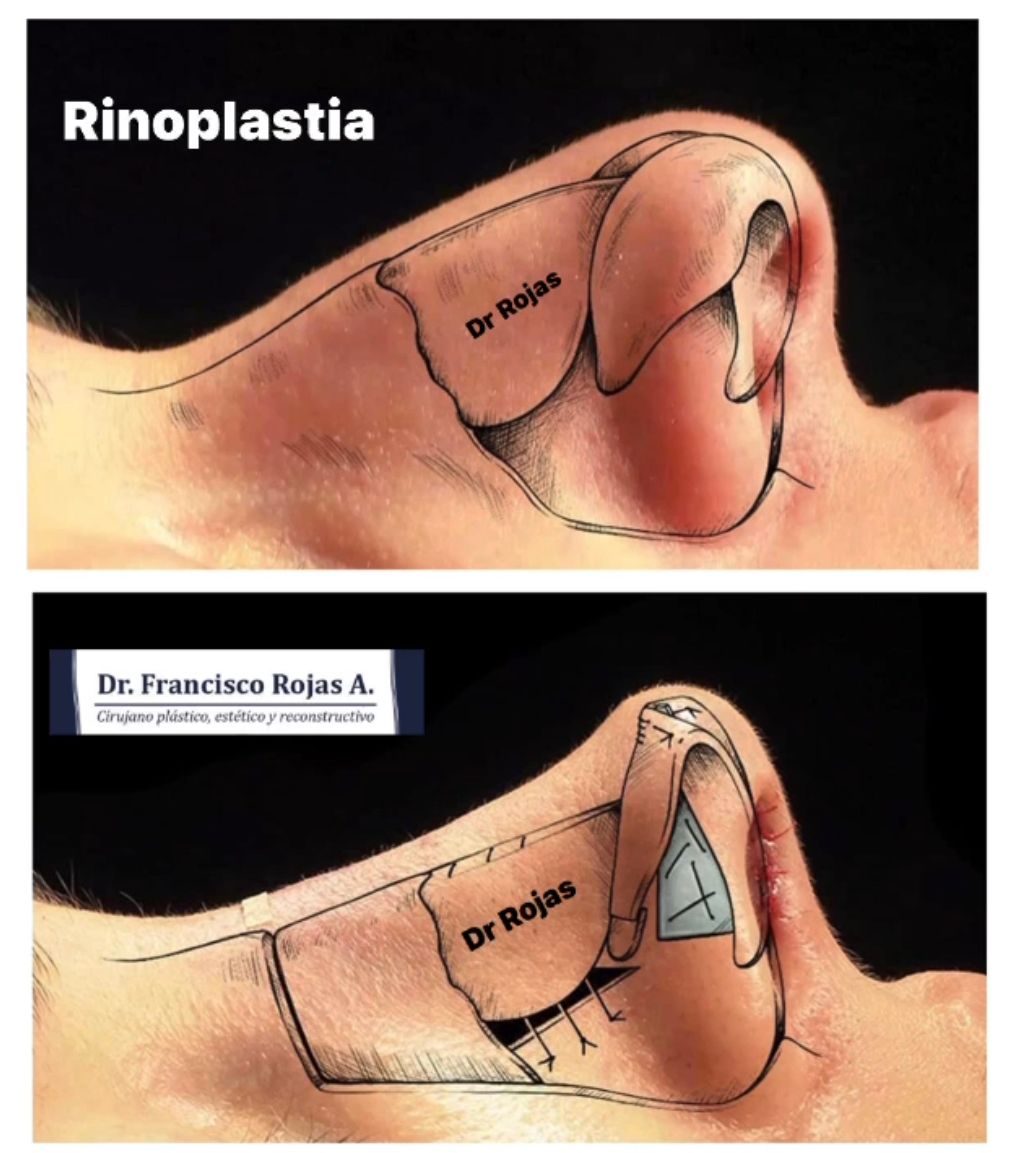 Francisco Rojas Aguilar-15