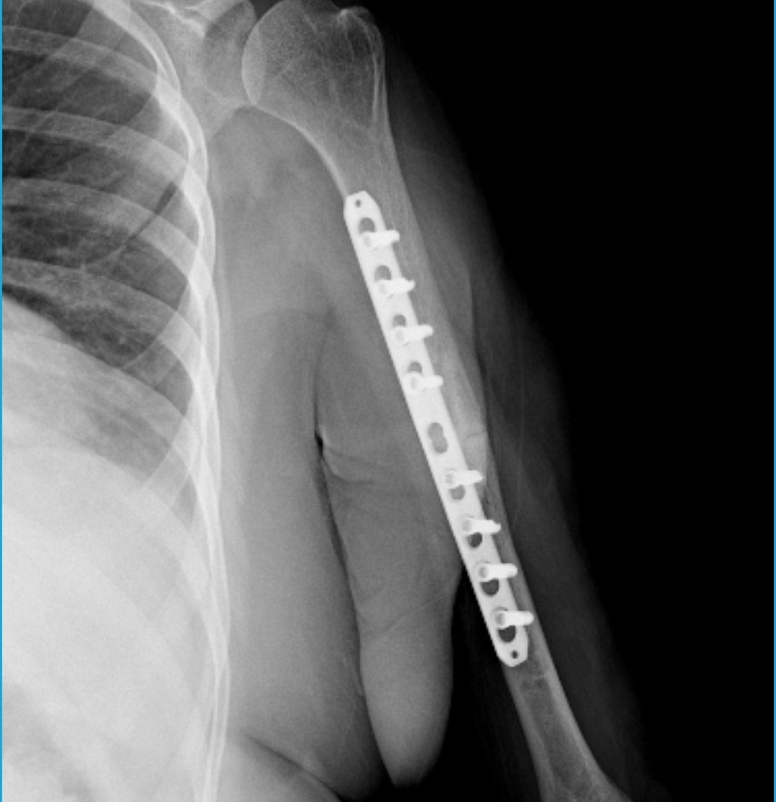 Alberto Lorenzo Cortés-7