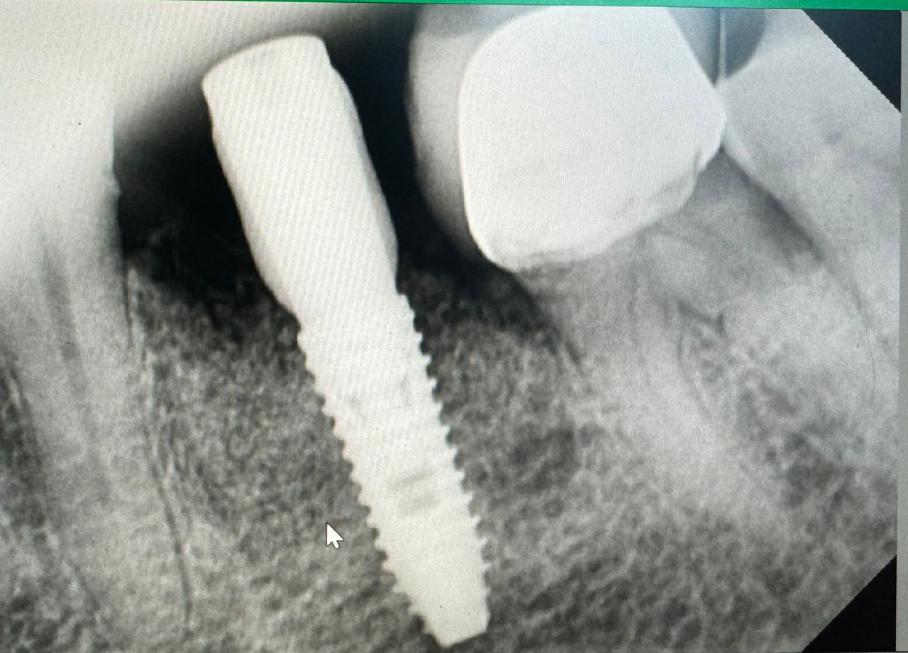 Luis Angel Carranza Resendez-9