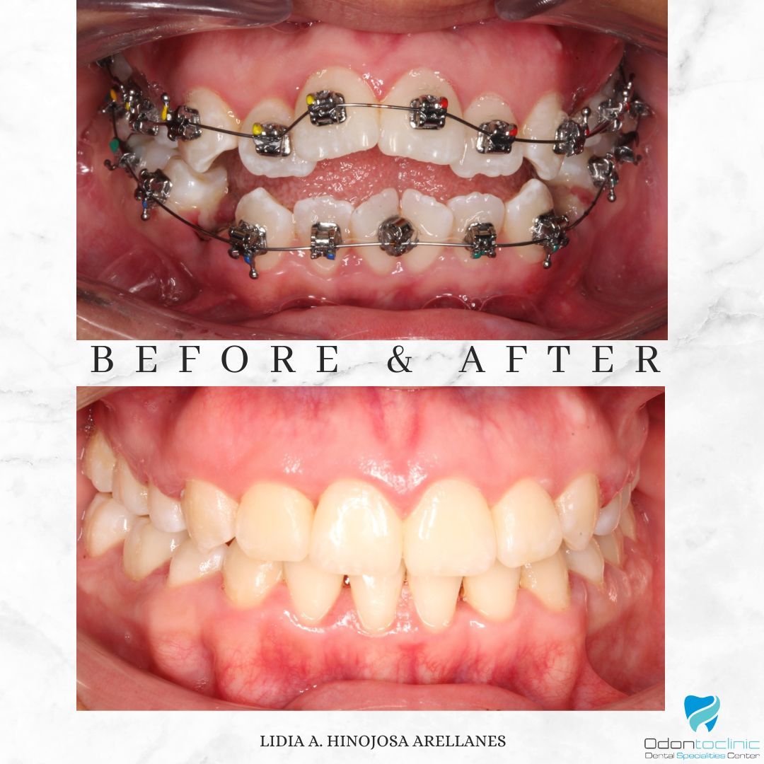 Lidia Abigail Hinojosa Arellanes-23