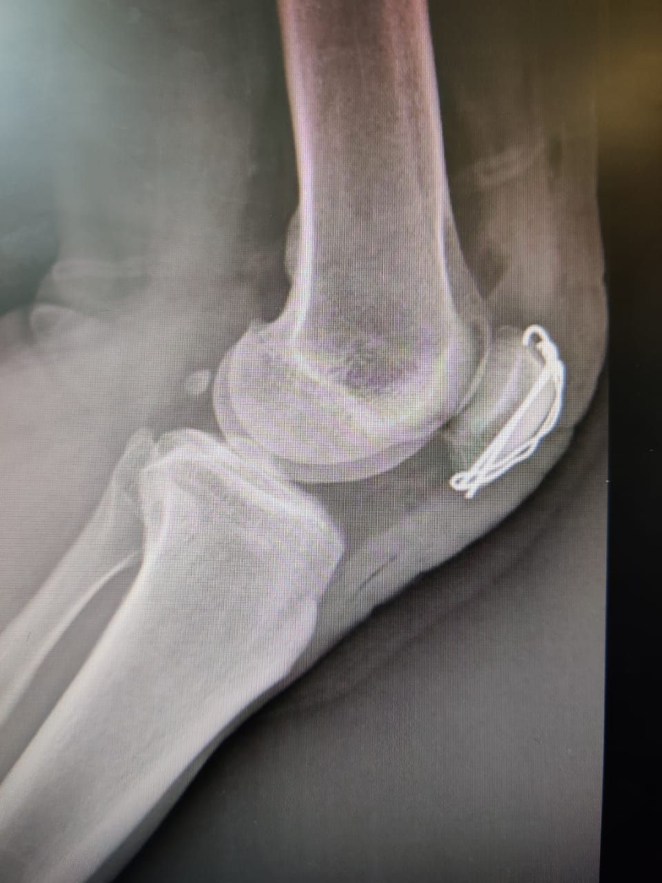 Sergio Espinosa Espinoza-10