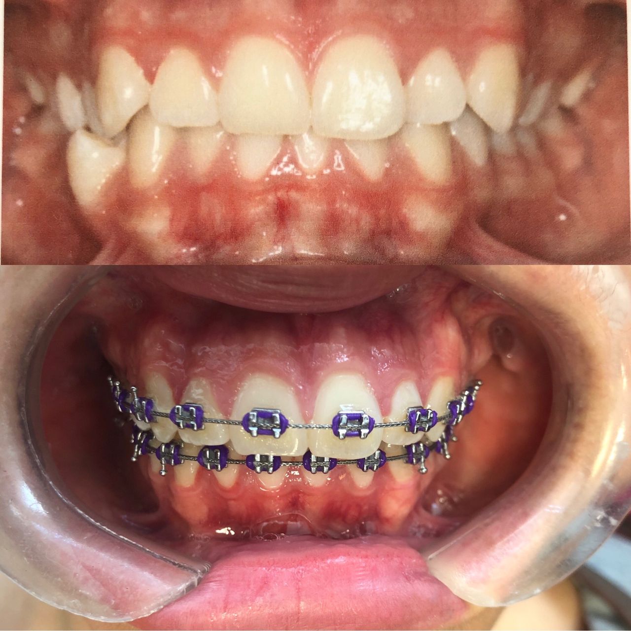 Blanca Margarita Lora Aguilar-3