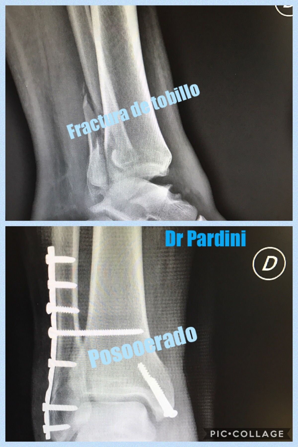 Carlos Gpe. Pardini Angulo-10