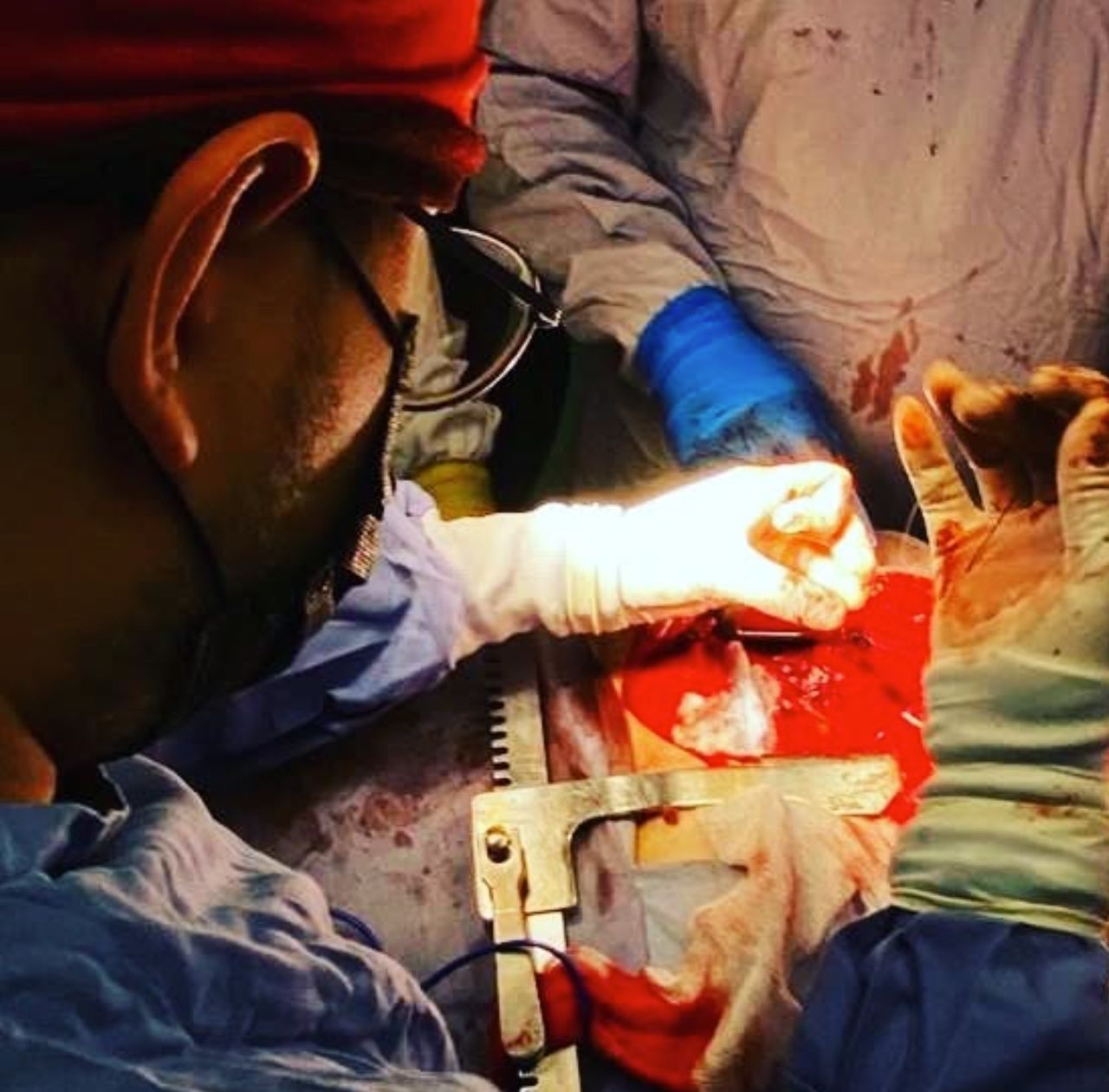 Hugo Alberto Escalante Escobedo-44