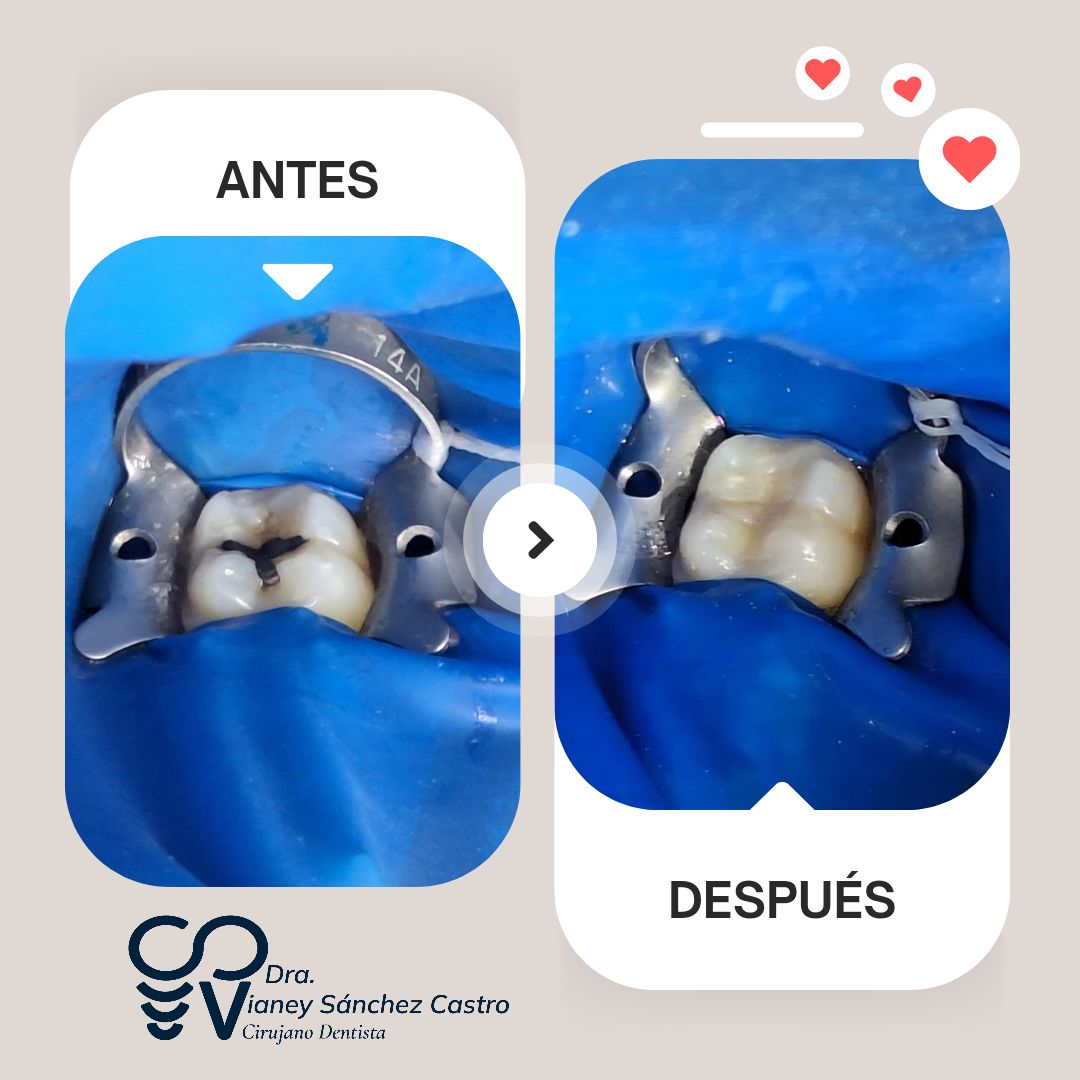 Vianey Sanchez Castro-1