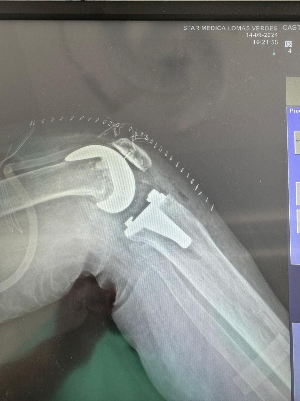 Ricardo Reyna Reynoso-1