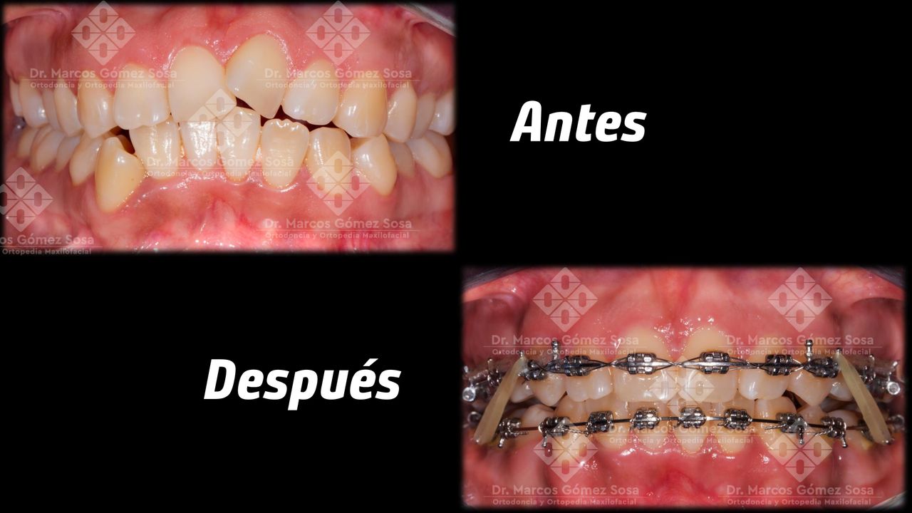 Marcos Gómez Sosa-11