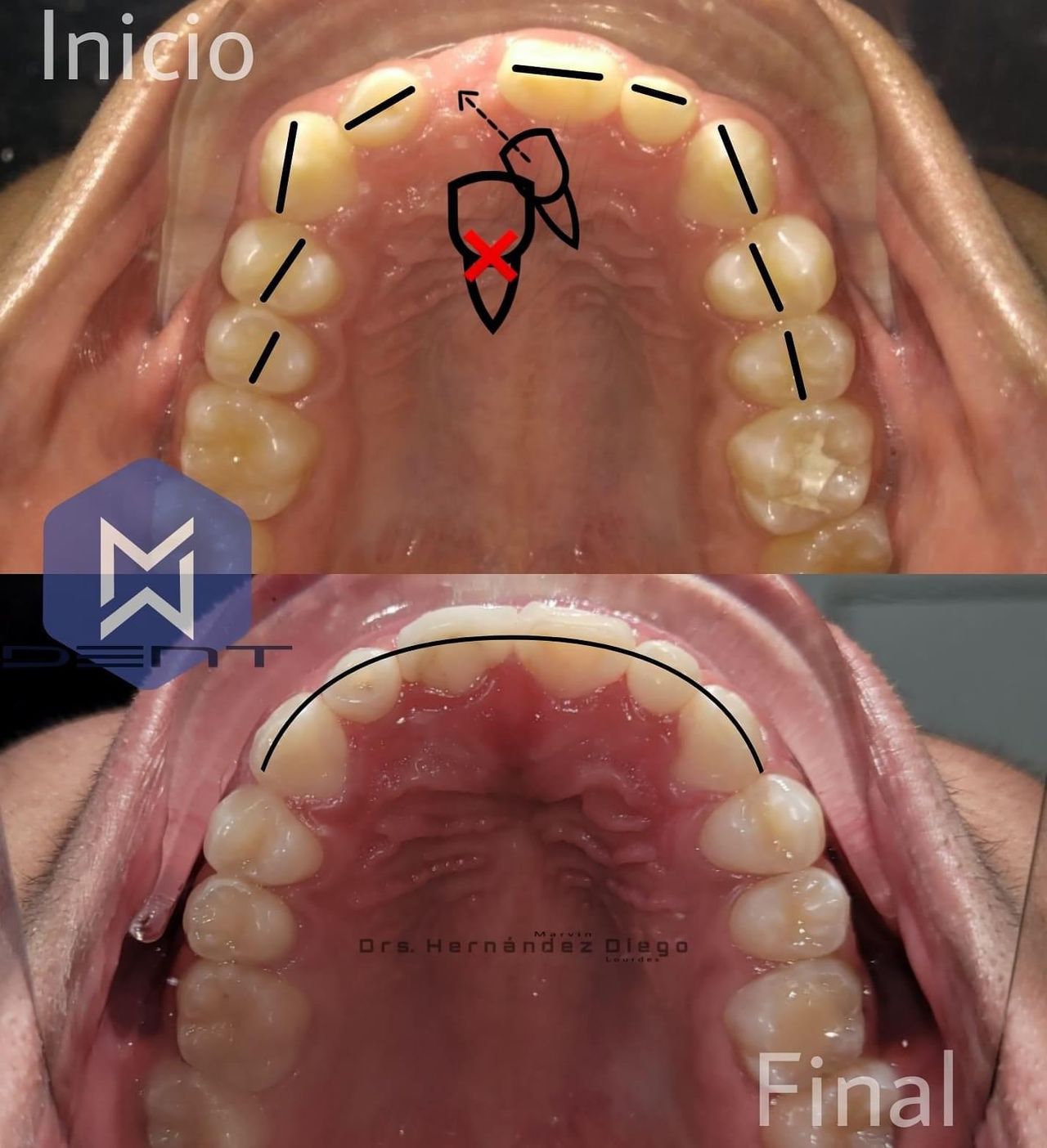 Marvin Adair Hernández Álvarez-29