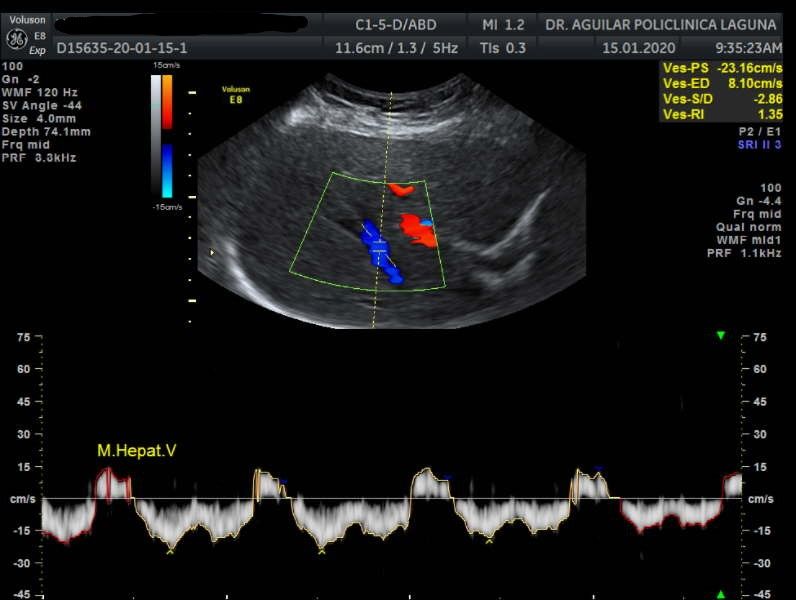 Edgar Fernando Aguilar Morales-17