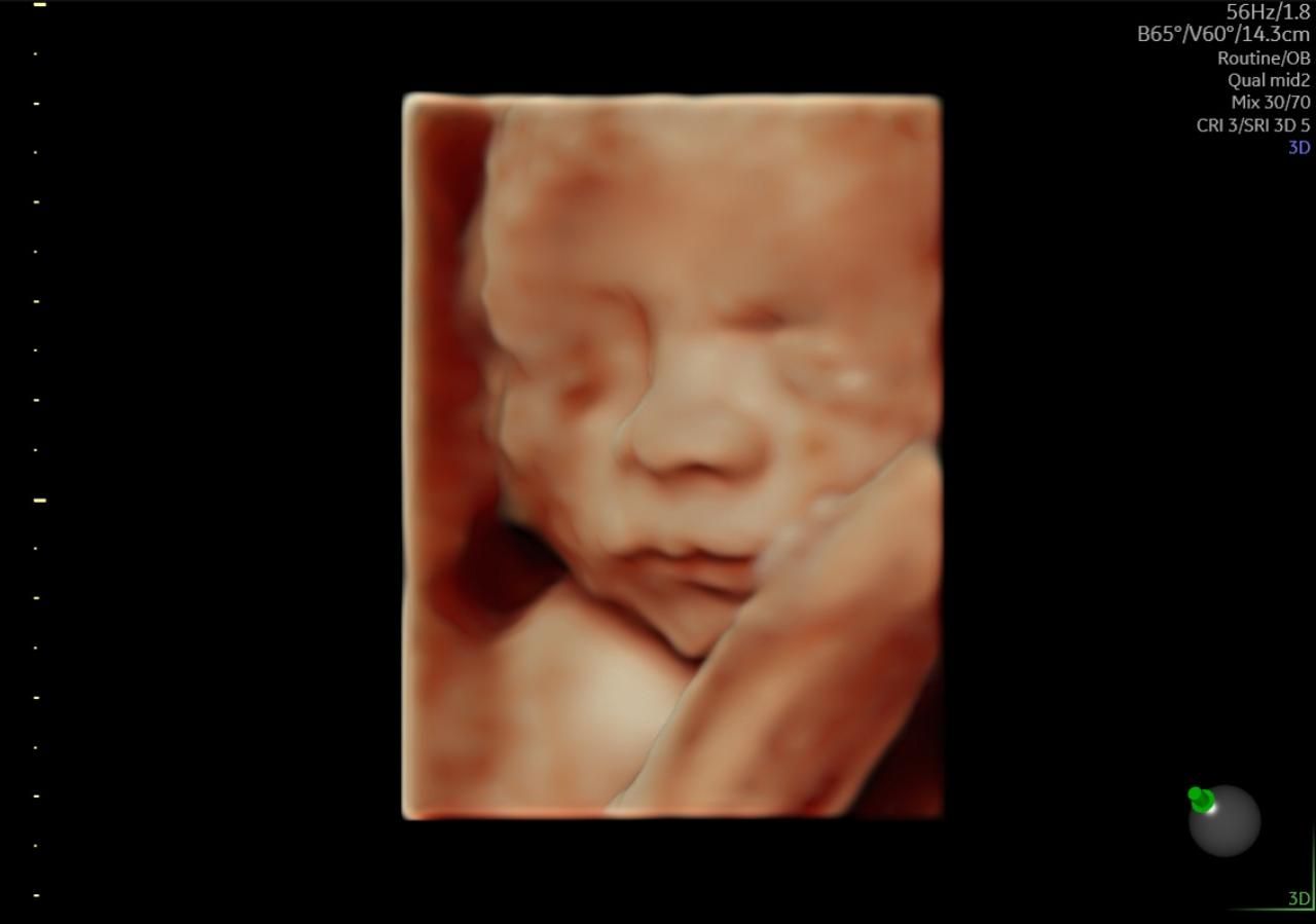 Martha Ivón Mondragón Cervantes-0